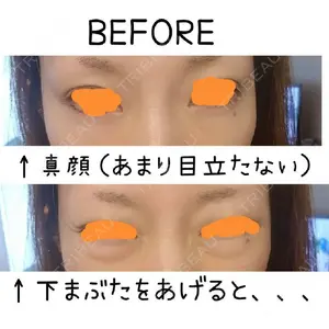 before image