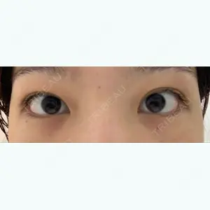 before image