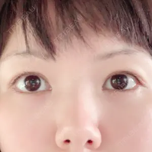 before image