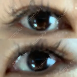 before image