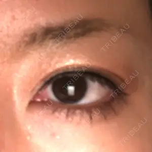 before image