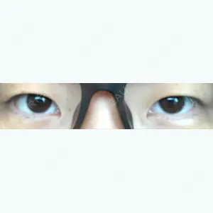 before image