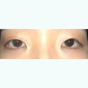 before image