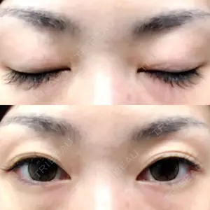 before image
