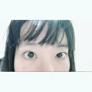before image