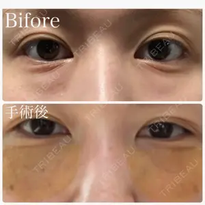 before image