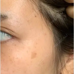 before image