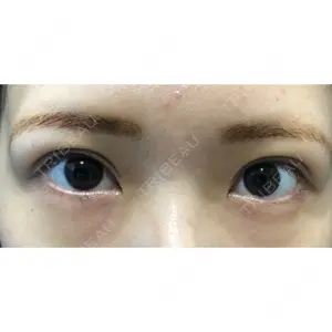 before image