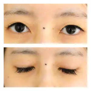before image
