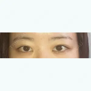 before image