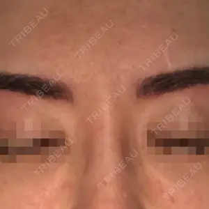 before image