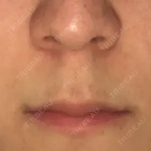 before image