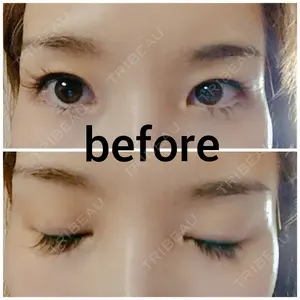 before image