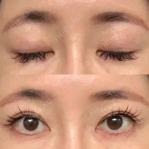 before image