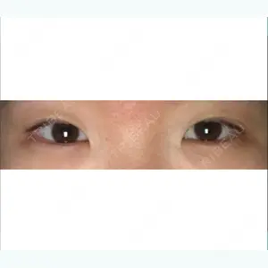 before image