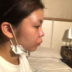 GIRIN美容外科口コミ