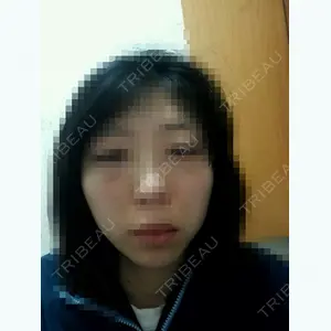before image