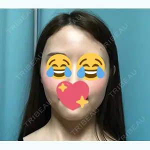 before image