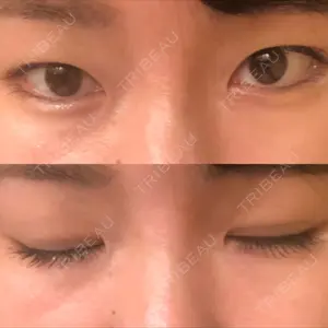 before image