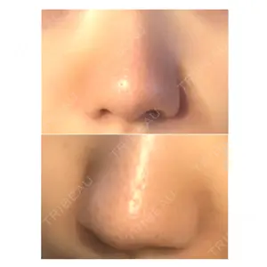before image