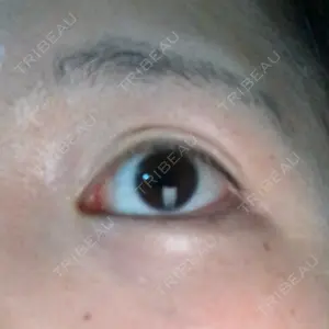 before image