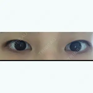 before image