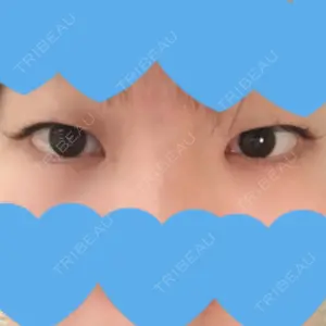口コミ