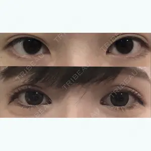 before image