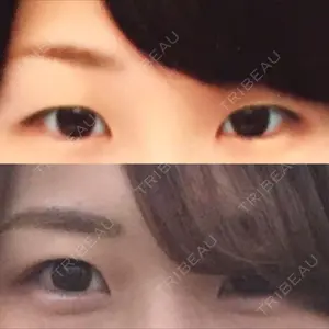 before image