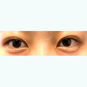 before image