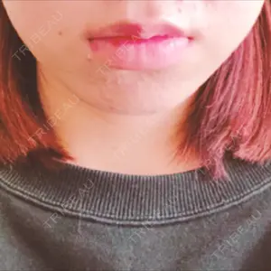 口コミ
