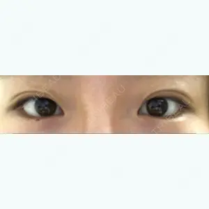before image