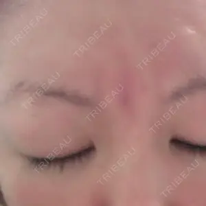 before image