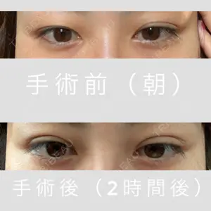 before image
