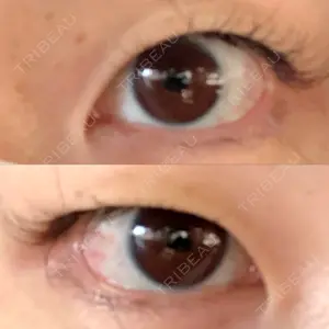 before image