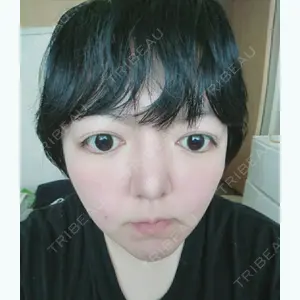 before image