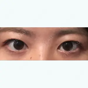 before image