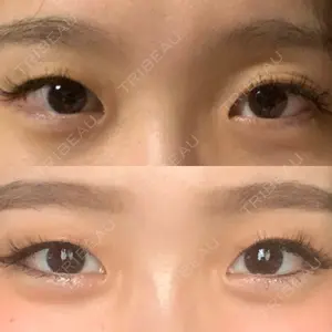 before image
