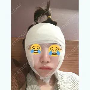 ヒューマン美容整形外科のソ・インス医師口コミ