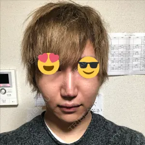 abijouクリニックのバン ボギュ医師口コミ