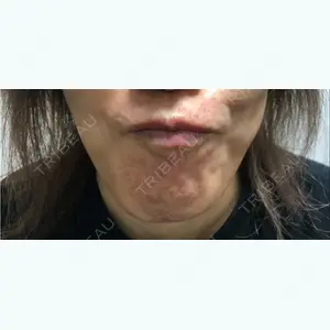 before image