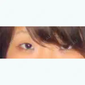 before image