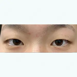 before image