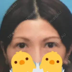 before image