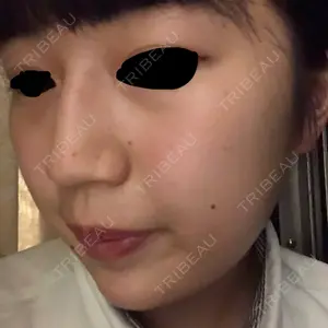 ワナビー整形外科口コミ