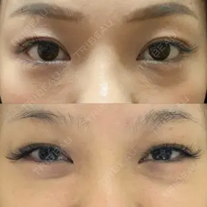 before image