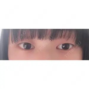 before image