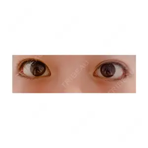 before image