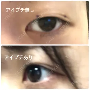 before image