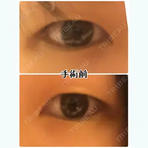 before image